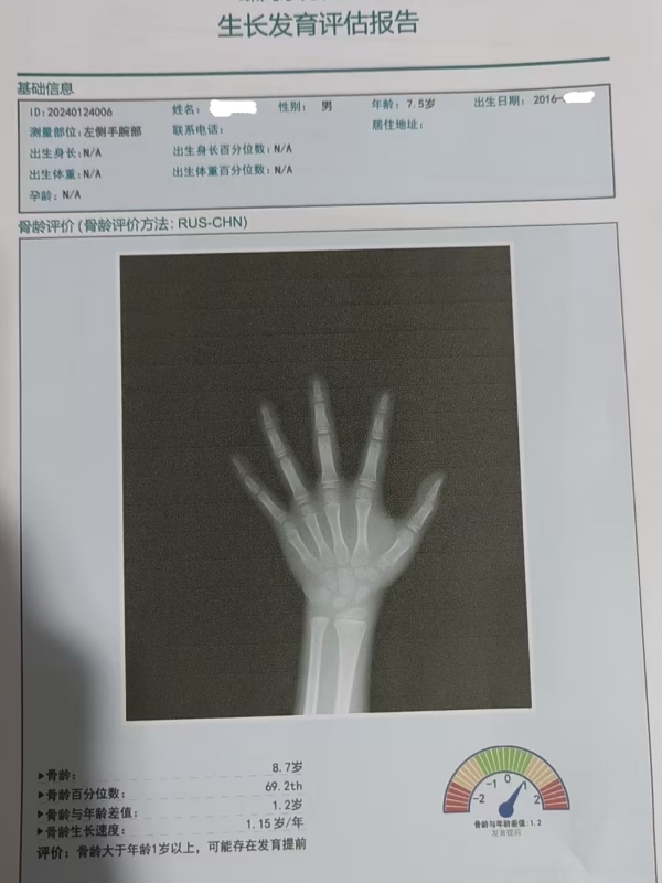 骨齡和身高有什么關(guān)系？每個(gè)孩子都有必要檢測(cè)嗎？